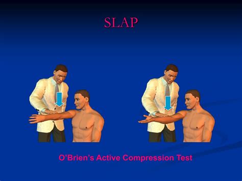 rotary compression test results|o'brien's sign shoulder.